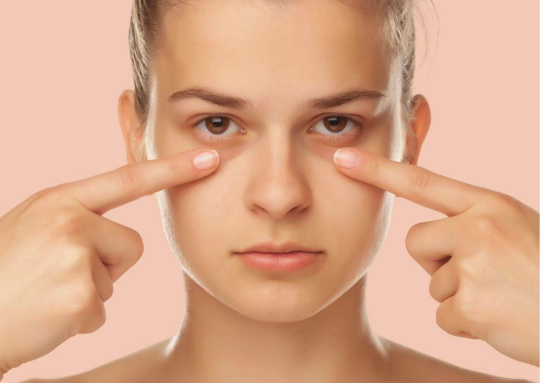 Causes of dark circles under the eyes